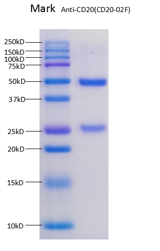 Anti-CD20-02F sdspage